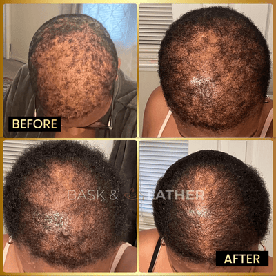 Men's Beard & Hair Growth Bundle