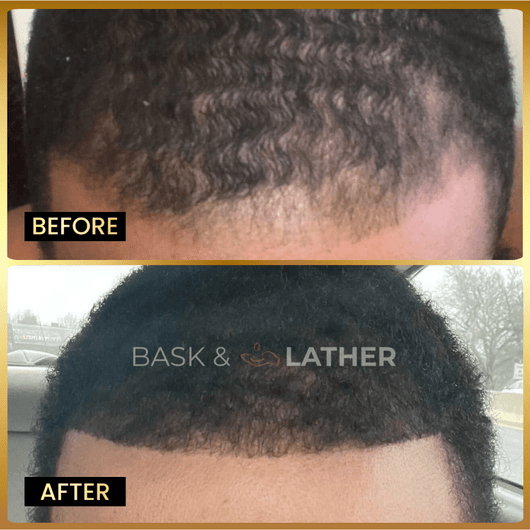 Men's Beard & Hair Growth Bundle