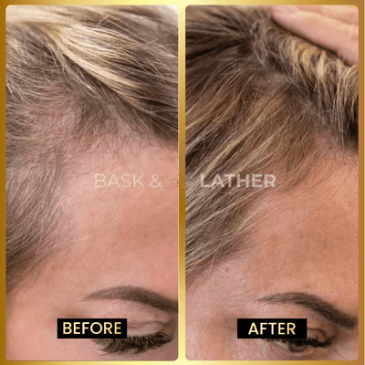 Jumbo Scalp Stimulator