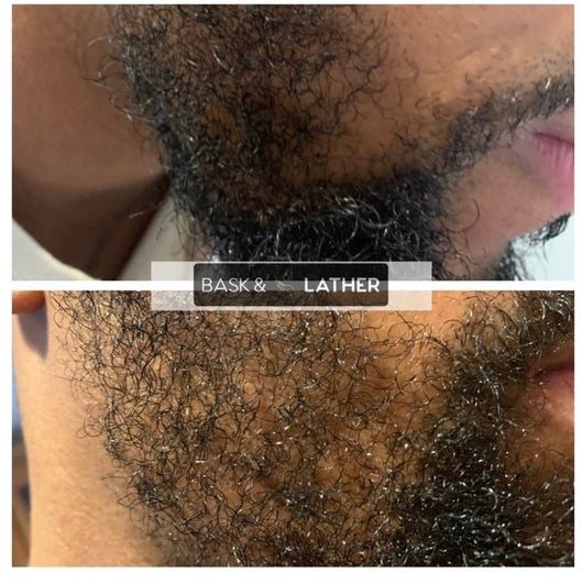 Men's Beard & Hair Growth Bundle