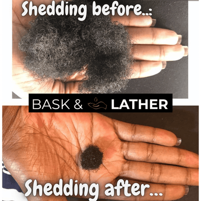 Healthy Hair Starter Kit - Limited Edition