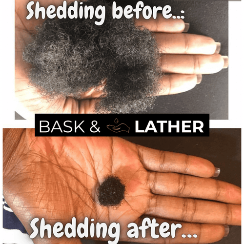 Healthy Hair Starter Kit - Limited Edition