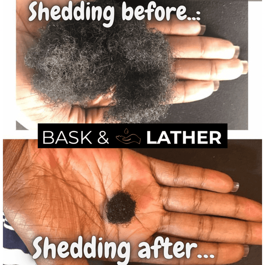 Healthy Hair Starter Kit - Limited Edition