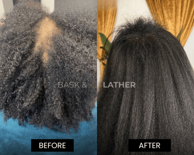 XL Cleanse & Growth Bundle - For Moisture & Hydration