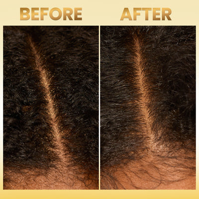 Scalp Balancing Shampoo