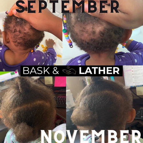 Nurture & Grow - Kids Healthy Hair Bundle