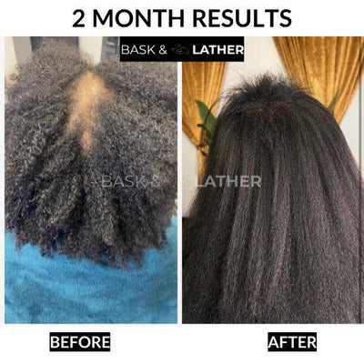 Healthy Hair Starter Kit - Limited Edition